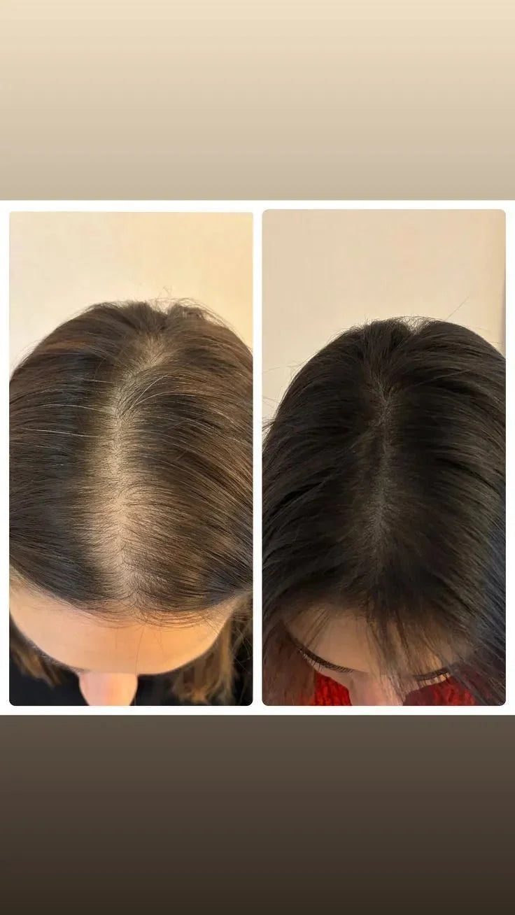 Comparaison avant-après de pousse rapide des cheveux avec traitement keratine Cynatine HNS, cheveux plus épais et foncés